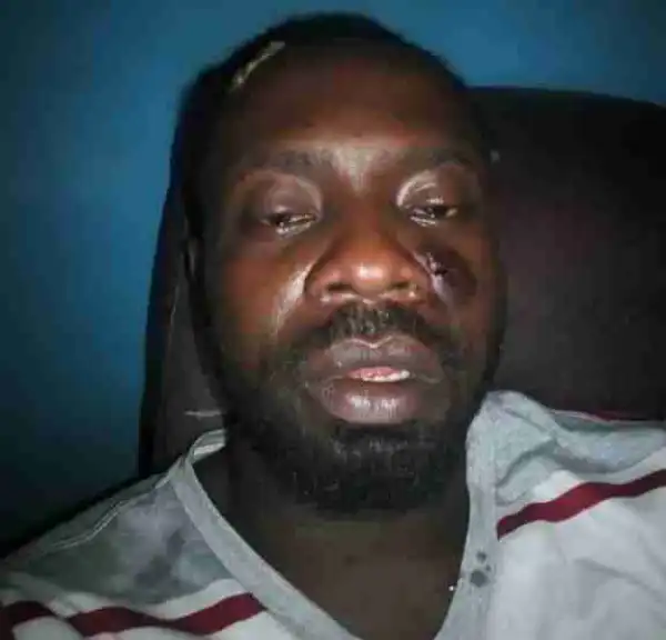 Singer Sky B Involves In A Ghastly Motor Accident In PortHarcout (Photos)